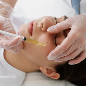 Sculptra® – Collagen Stimulation & Facial Rejuvenation